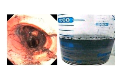 Sở Y tế TP.HCM: Phác đồ điều trị ngạt khói phát huy hiệu quả góp phần cứu sống các nạn nhân của vụ cháy xảy ra tại phường Tân Thới Hiệp